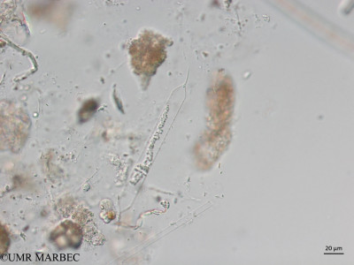 phyto/Brazilian_Nordeste/Northeastcoast_station31/ABRACOS2 April 2017/Rhizosolenia cylindrus (Snap-301)(copy)_thumb.jpg